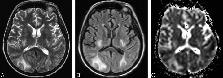 Fig 3.