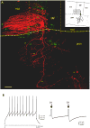 Fig. 11
