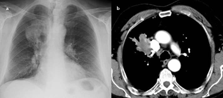 Figure 2. a, b