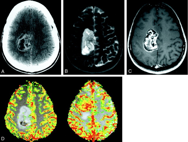 Fig 1.