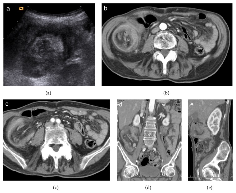 Figure 13