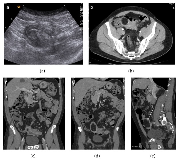 Figure 5