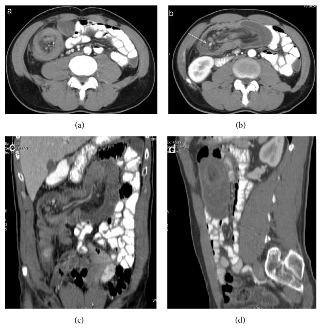 Figure 2