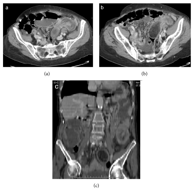 Figure 11