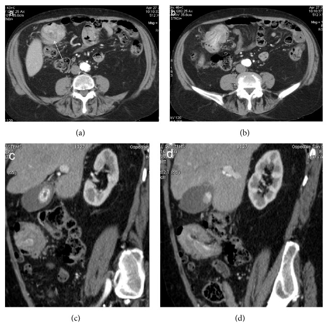 Figure 14