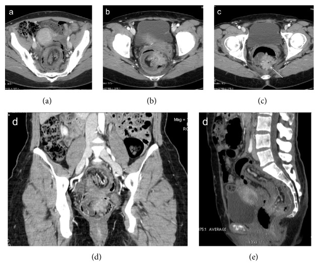 Figure 12