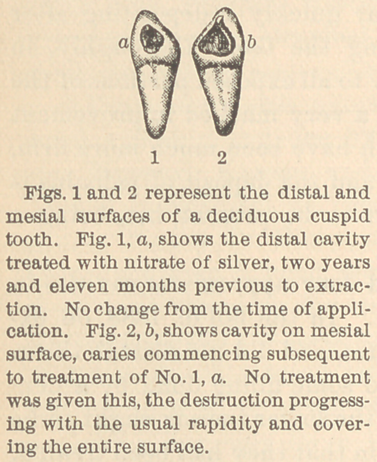 Figs. 1 and 2