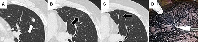 Figure 4