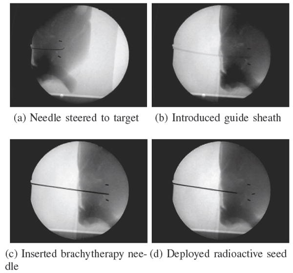 Fig. 10