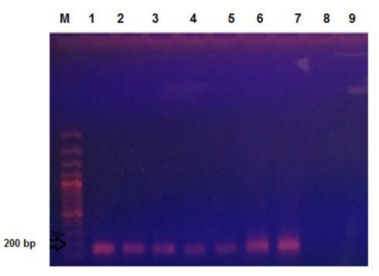 Fig. (1)