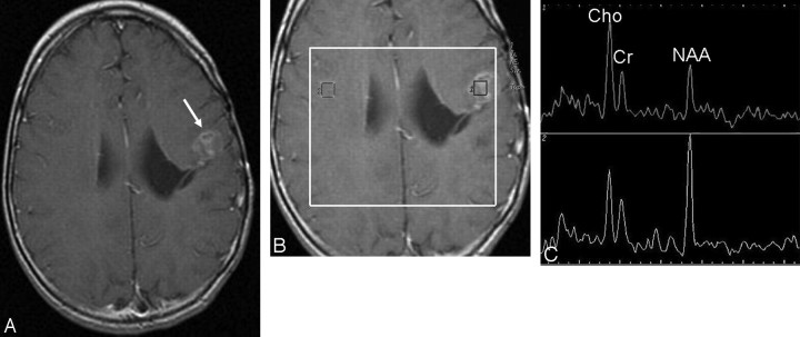 Fig 2.