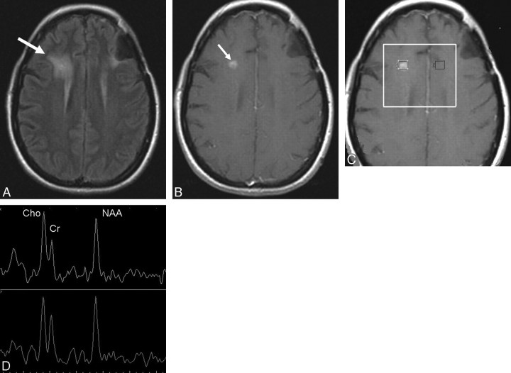 Fig 3.