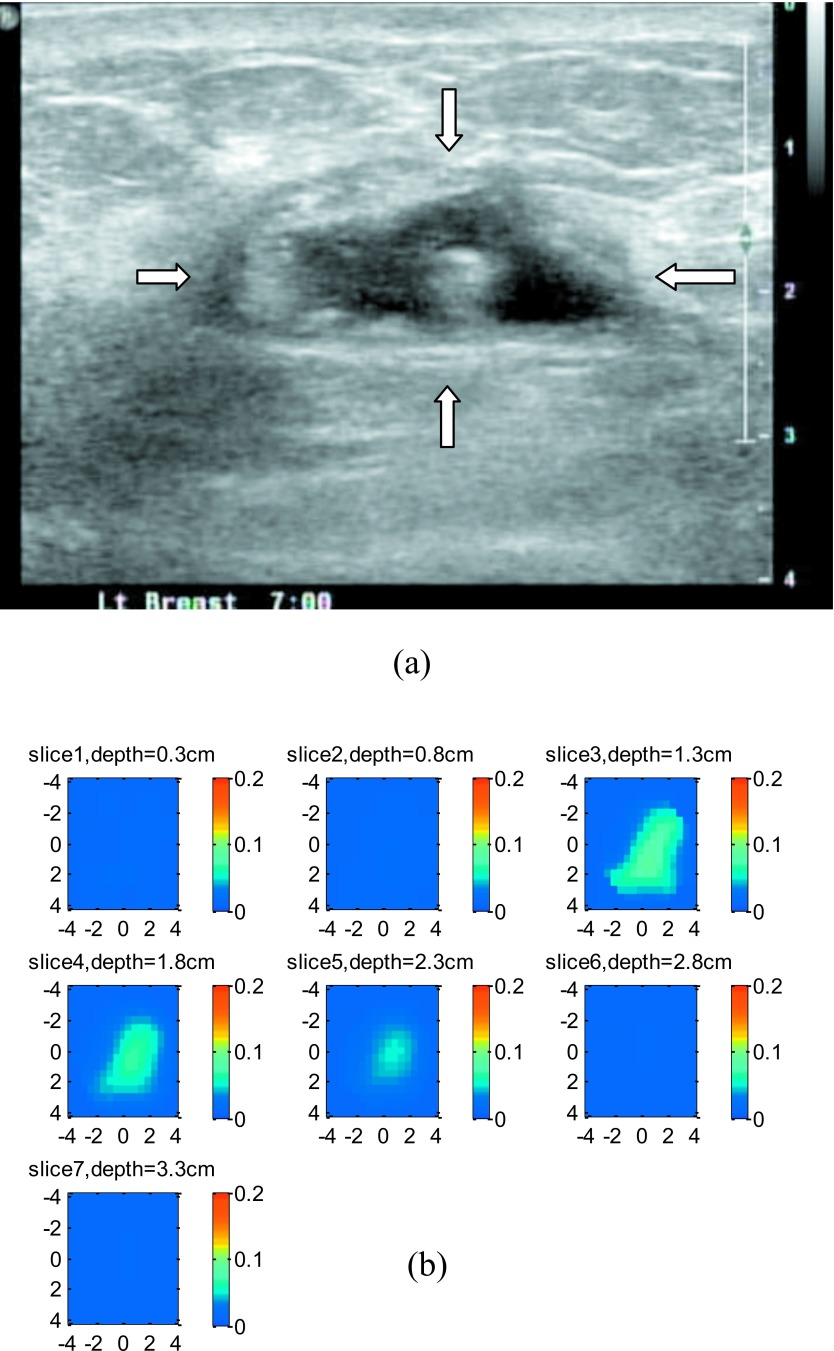 Figure 13