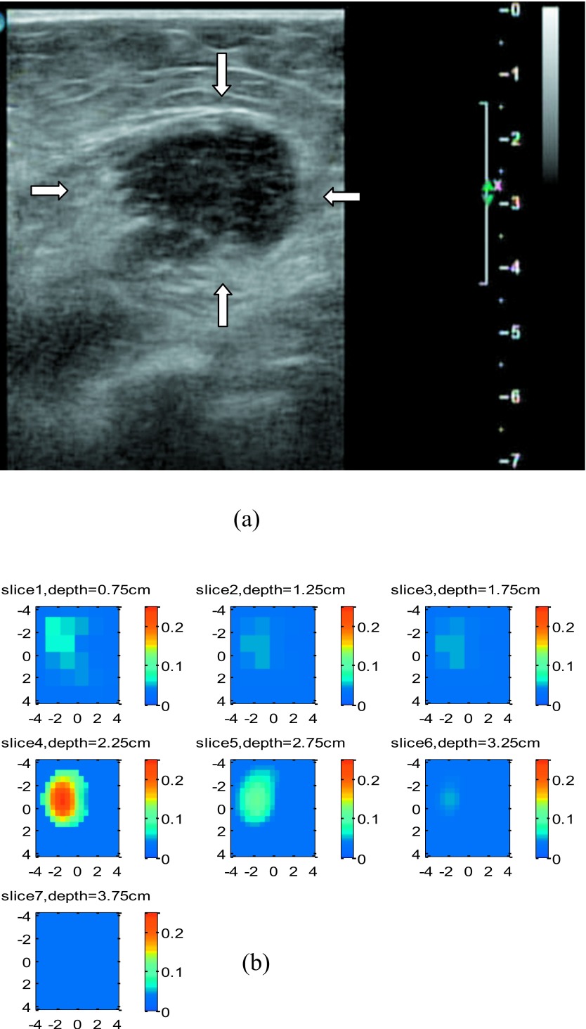 Figure 12