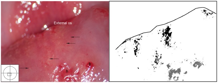 Figure 25