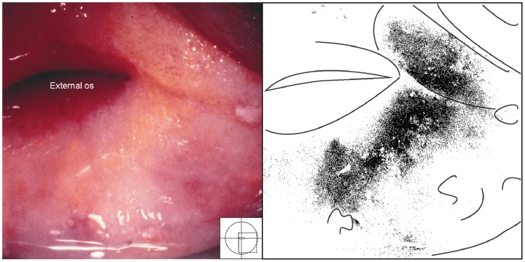 Figure 14