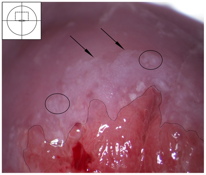 Figure 20