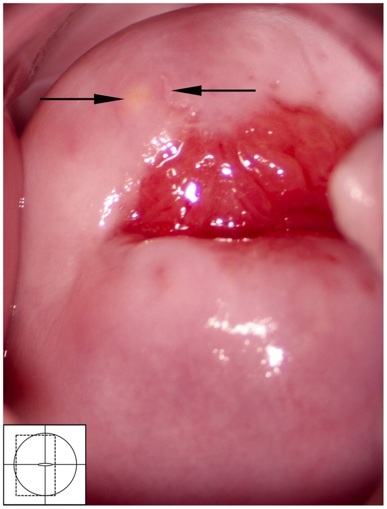 Figure 22