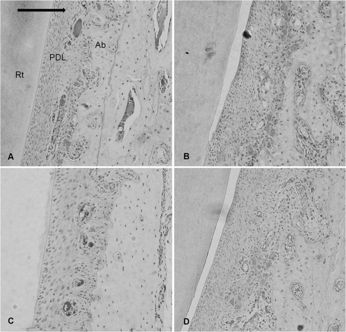 Figure 4. Immunohistochemical staining for experimental groups in the range of interest at day 5 of relapse, ×200. (A) Control group. (B) Irradiation group. (C) Doxycycline group. (D) Irradiation + doxycycline group. Solid arrow indicates direction of relapse movement; Rt, incisor root; PDL, periodontal ligament; Ab, alveolar bone.