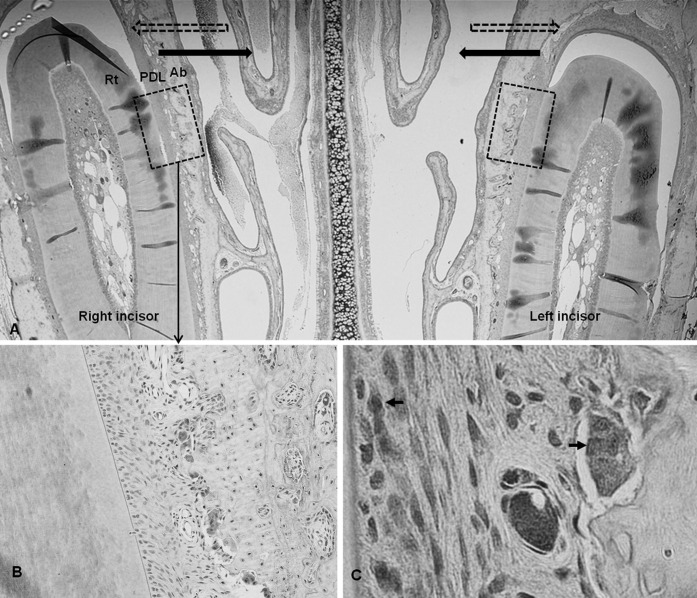 Figure 2. Microphotograph of immunohistochemical staining in the experimental groups. (A) Representative microphotograph of the whole observation area, including teeth and periodontal tissues used in the experiment, ×20. Dashed arrow indicates direction of previous orthodontic tooth movement; solid arrow, direction of relapse movement. Former tension sides were changed into compression sides. Dashed box indicates the range of interest. (B) Immunoreactivity to MMPs was seen in the multinucleated cells along the resorbed bone surface, ×200.(C) Immunoreactive cells, ×1000. Rt indicates incisor root; PDL, periodontal ligament; Ab, alveolar bone.