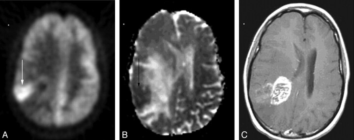 Fig 2.