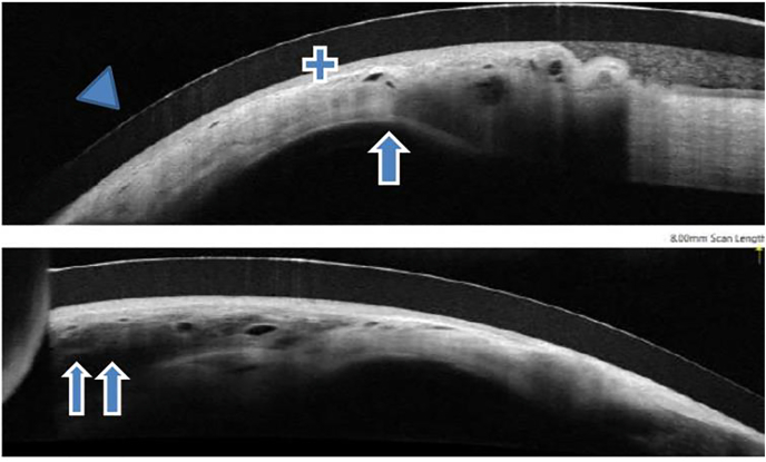 Fig. 2A