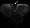 Figure 1b: