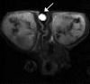 Figure 1a: