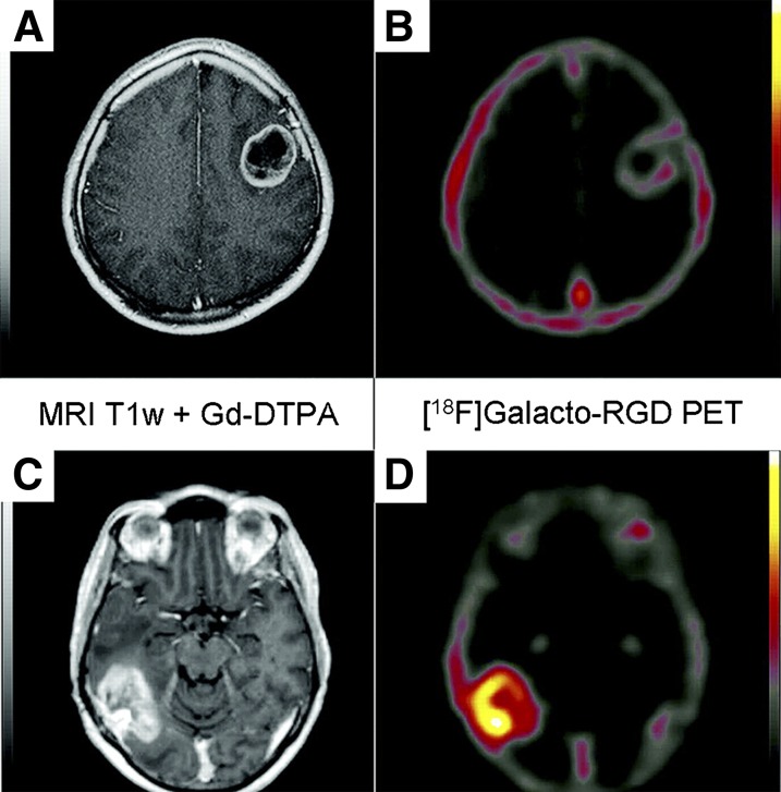 Fig. 22.