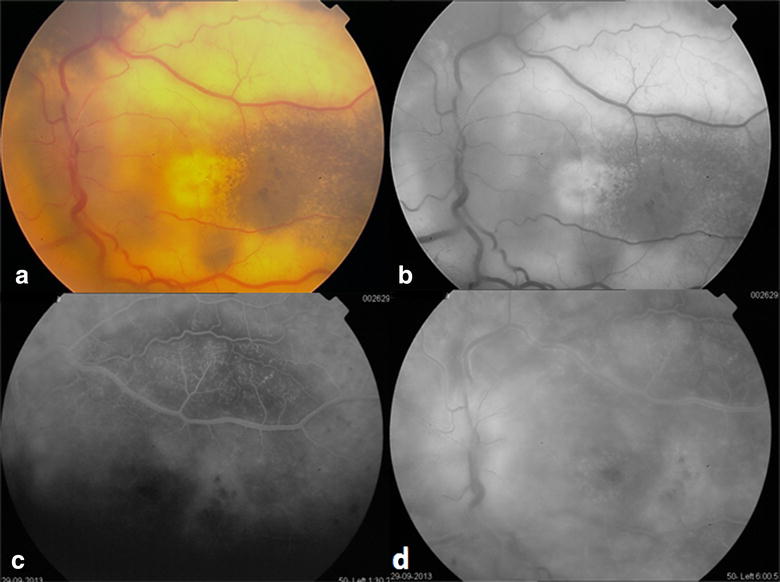 Fig. 2