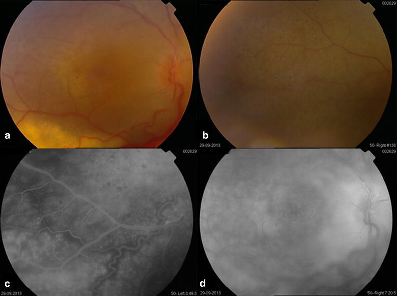 Fig. 1