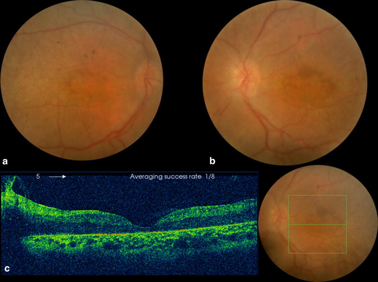 Fig. 3