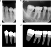 Fig. 5