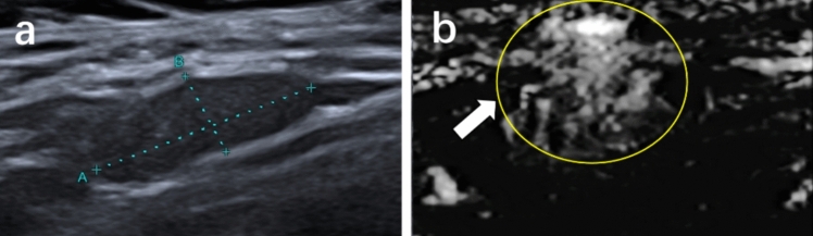 Fig. 6