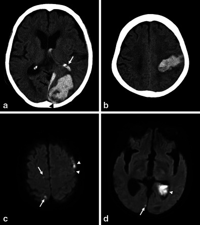 Fig. 4