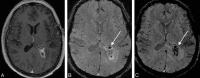 Fig 25.