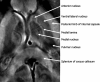 Fig 13.