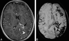 Fig 17.