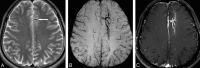 Fig 16.