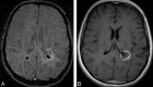 Fig 27.