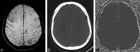Fig 19.