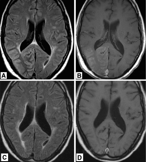 Fig. 1