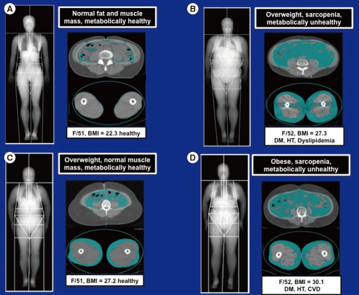 Fig. 2