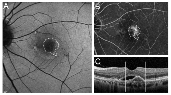 Fig. 2