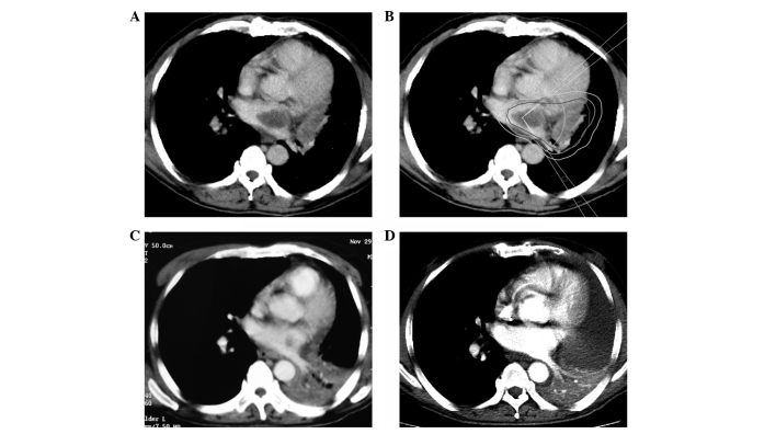 Figure 1.