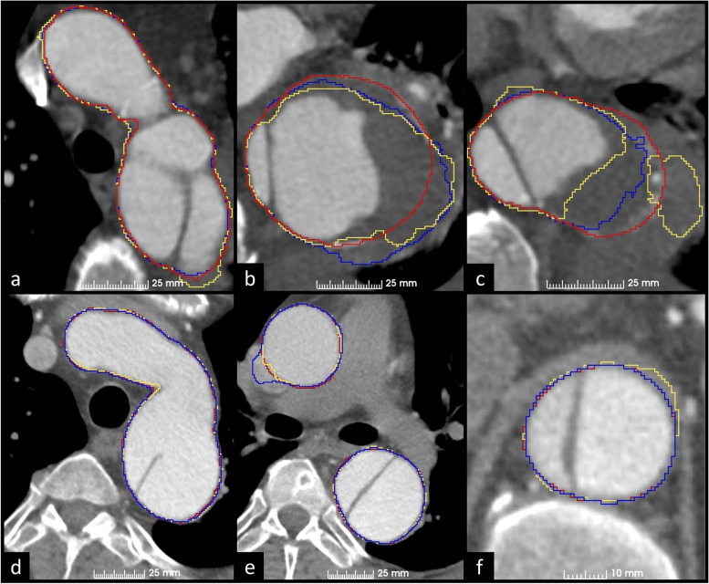 Fig. 5