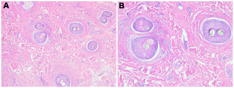 Figure 10