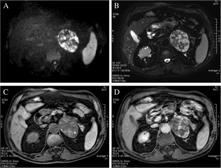 Fig. 2