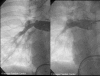 Fig. 16