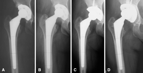 Fig. 3A–D